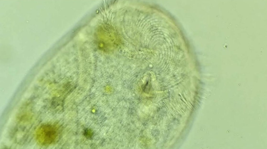 Stentor roeselii